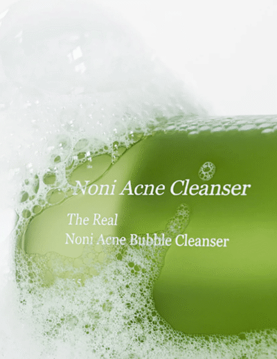 TheRealNoniAcneBubbleLimpador Facial_1